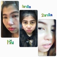 La Grace Clinic เซ็นทรัลชิดลม