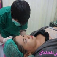 ร้อยไหมก้างปลากับคุณหมอ คุณหมอทำค่อนข้างเบามือ เจ็บแต่ไม่มาก ไหวอยู่