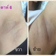 La Grace Clinic เซ็นทรัลแจ้งวัฒนะ