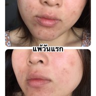 Makalin  Clinic  เซนทรัลพระราม 9