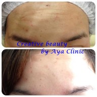 AYA Clinic ยูเนี่ยนมอลล์