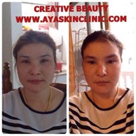 AYA Clinic ยูเนี่ยนมอลล์