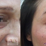 AYA Clinic ยูเนี่ยนมอลล์