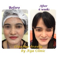 AYA Clinic ยูเนี่ยนมอลล์