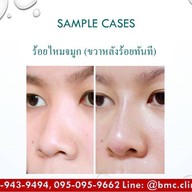 BMC CLINIC เกษตรนวมินทร์