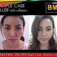 BMC CLINIC เกษตรนวมินทร์