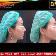 BMC CLINIC เกษตรนวมินทร์