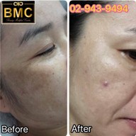 BMC CLINIC เกษตรนวมินทร์