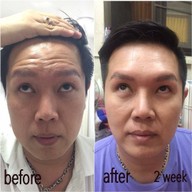 BMC CLINIC เกษตรนวมินทร์