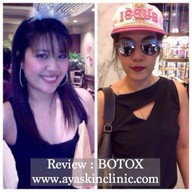 AYA Clinic ยูเนี่ยนมอลล์