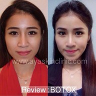 AYA Clinic ยูเนี่ยนมอลล์