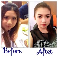 Doctor Grace clinic รามคำแหง 65