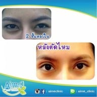 Aime' Clinic ลาดพร้าว