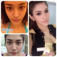 Aime' Clinic ลาดพร้าว