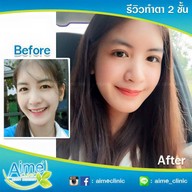 Aime' Clinic ลาดพร้าว