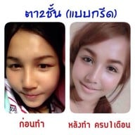 Aime' Clinic ลาดพร้าว