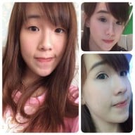 Aime' Clinic ลาดพร้าว