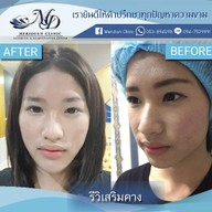 เมอริเดียน คลีนิก นิมมานเหมินทร์