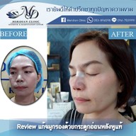 เมอริเดียน คลีนิก นิมมานเหมินทร์