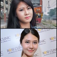 Mew Clinic ศัลยกรรม เชียงใหม่  เชียงใหม่