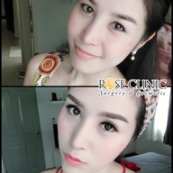 Mew Clinic ศัลยกรรม เชียงใหม่  เชียงใหม่