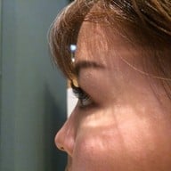 ต่อแบบ Natural