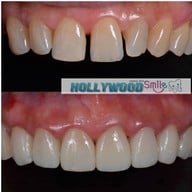 hollywood smile dental