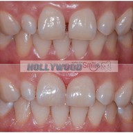 hollywood smile dental