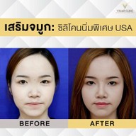 V PLAST CLINIC สาขา บางแสน