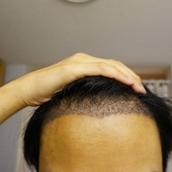 เมนูของร้าน Apex Profound Beauty ทองหล่อ