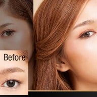 Luxury Clinic เซนทรัลปิ่นเกล้า