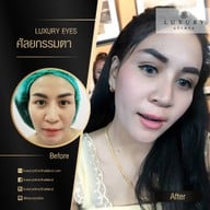 Luxury Clinic เซนทรัลปิ่นเกล้า