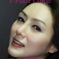 V PLAST CLINIC สาขา บางแสน