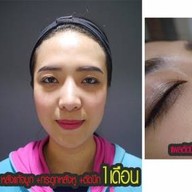 เมนูของร้าน MAXi Cosmetic Surgery