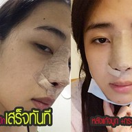 เมนูของร้าน MAXi Cosmetic Surgery