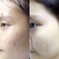 WE Skin and Aesthetic Clinic