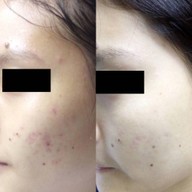 WE Skin and Aesthetic Clinic