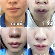Mew Clinic ศัลยกรรม เชียงใหม่  เชียงใหม่