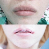 Mew Clinic ศัลยกรรม เชียงใหม่  เชียงใหม่