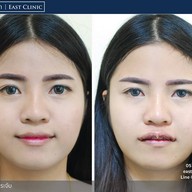 อีสต์ คลินิก - East Clinic เชียงใหม่ คลองชลประทาน