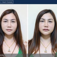 อีสต์ คลินิก - East Clinic เชียงใหม่ คลองชลประทาน