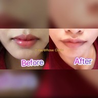 Mew Clinic ศัลยกรรม เชียงใหม่  เชียงใหม่