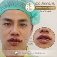 เมอริเดียน คลีนิก นิมมานเหมินทร์