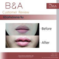 DIAA Clinic ดีย่า คลินิก นิมมานเหมินทร์ ซ. 3