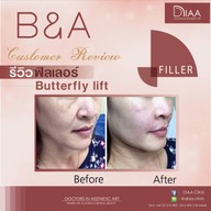 DIAA Clinic ดีย่า คลินิก นิมมานเหมินทร์ ซ. 3