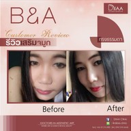 DIAA Clinic ดีย่า คลินิก นิมมานเหมินทร์ ซ. 3
