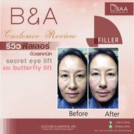 DIAA Clinic ดีย่า คลินิก นิมมานเหมินทร์ ซ. 3