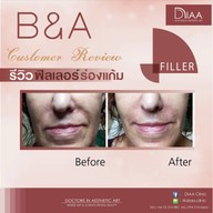 DIAA Clinic ดีย่า คลินิก นิมมานเหมินทร์ ซ. 3