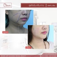 DIAA Clinic ดีย่า คลินิก นิมมานเหมินทร์ ซ. 3