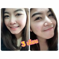 เมนูของร้าน Dmor Clinic รัชดาภิเษก